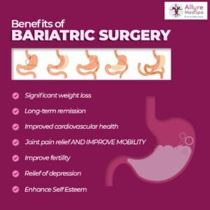 benefits of bariatric surgery: weight loss, increased confidence and fertility at allure medspa mumbai