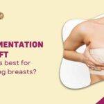 Breast Augmentation vs. Breast Lift – Or Both What’s Best for Sagging Breasts