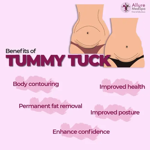 Benefits of Tummy Tuck Surgery Mumbai, India