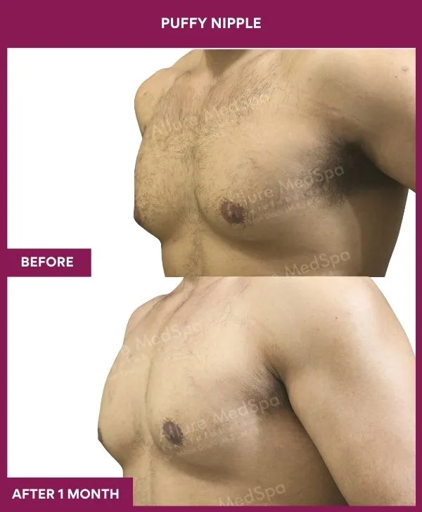 1 PUFFY NIPPLE (2)_64_