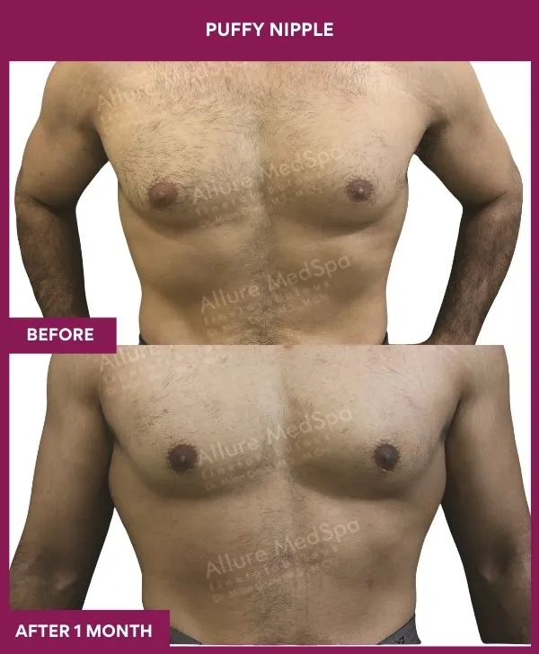 1 PUFFY NIPPLE (3)_64_