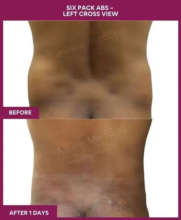 11-10-9-Six Pack Abs-