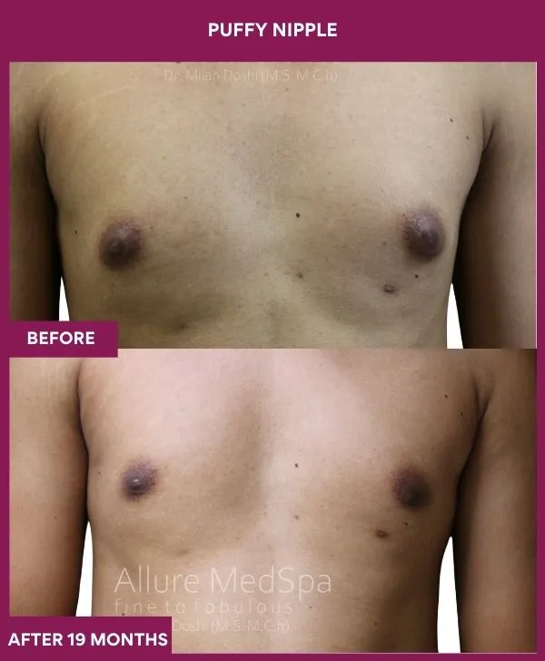 2 PUFFY NIPPLE (5)_66