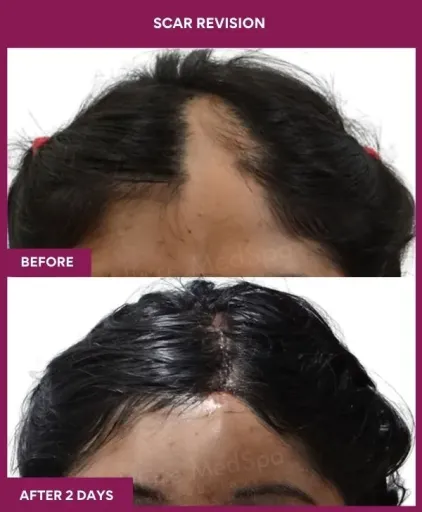 7 Scar Revision_10_ (1)