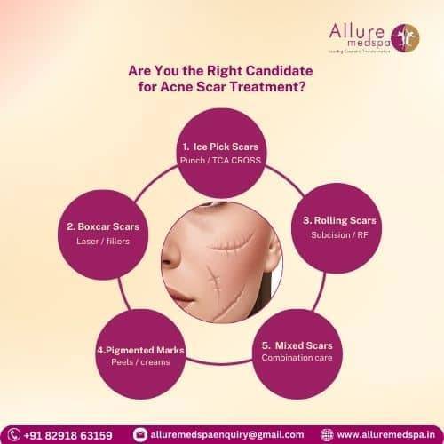 Are You the Right Candidate for Acne Scar Treatment in Mumbai, India