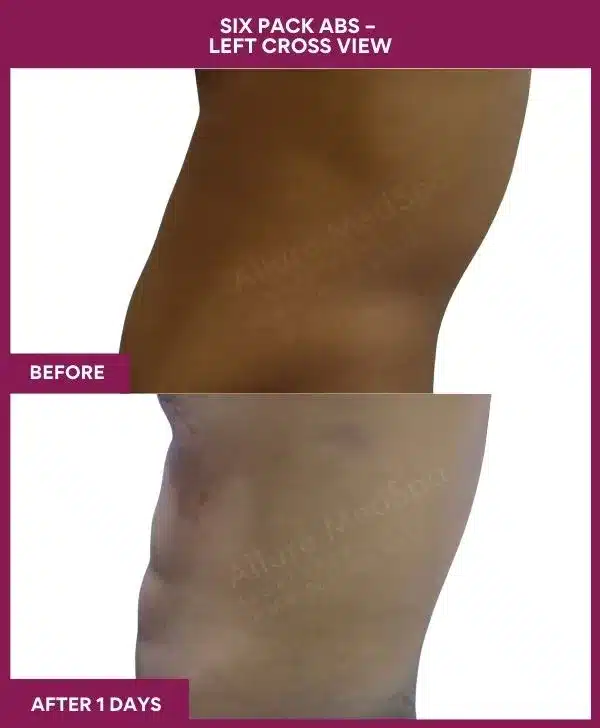 2-9-Six Pack Abs -- (1)