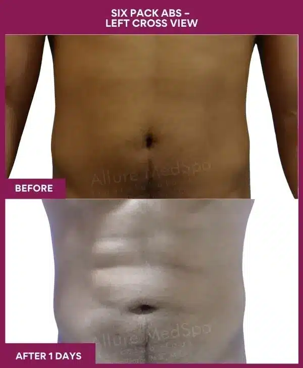 2-9-Six Pack Abs -- (2)