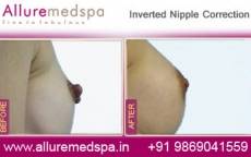 inverted-nipple-correction-before-and-after-gallery-mumbai-india
