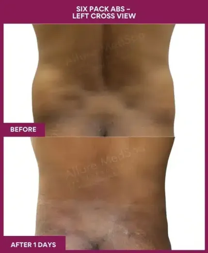 11-10-9-Six Pack Abs-