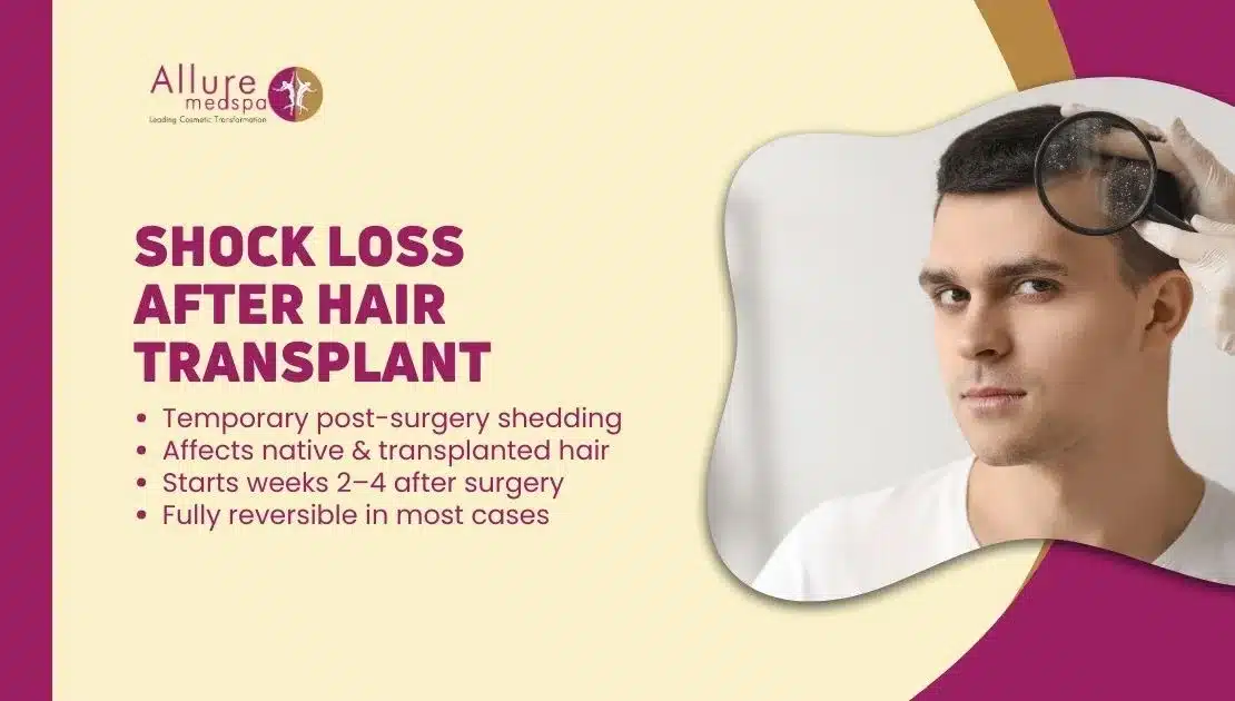 SHOCK LOSS AFTER HAIR TRANSPLANT in Mumbai, India