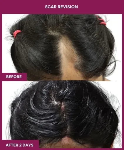 7 Scar Revision_10_ (2)