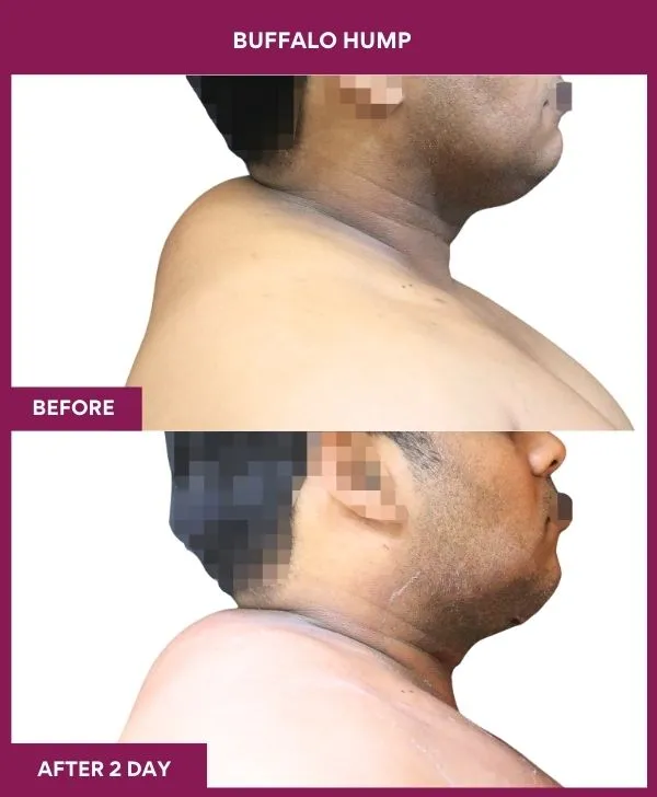 Buffalo Hump (2)