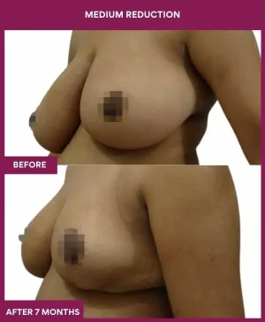 2 medium reduction (2)