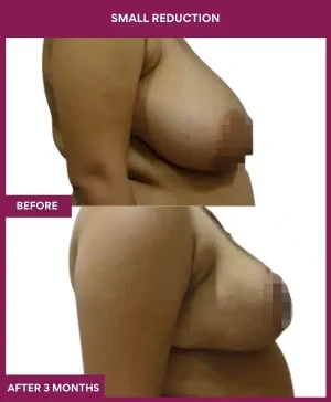 2 small reduction_106_ (3)