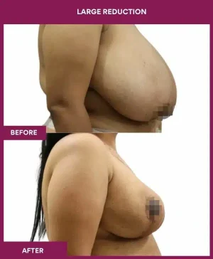 3 large Reduction (3)