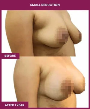 3 small reduction (2)