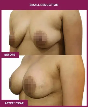 3 small reduction (3)