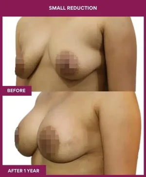 3 small reduction (3)_107_