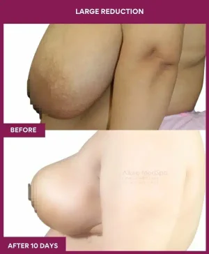 4 large Reduction (2)