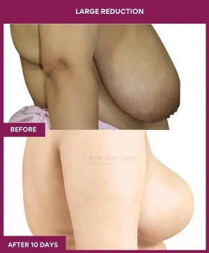 4 large Reduction (3)