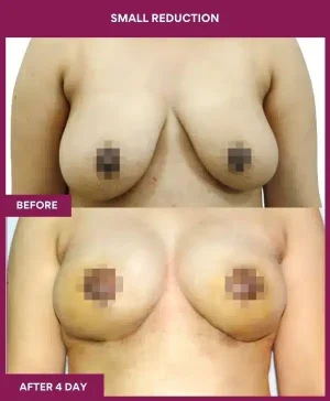 4 small reduction_112_ (1)