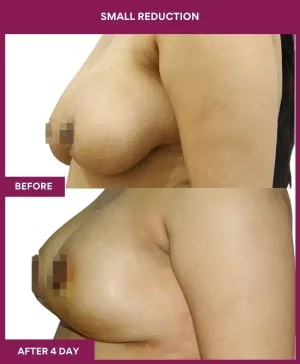 4 small reduction_112_ (3)