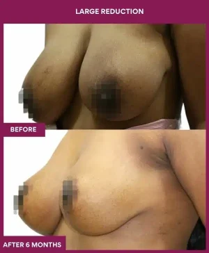 5 large Reduction (2)