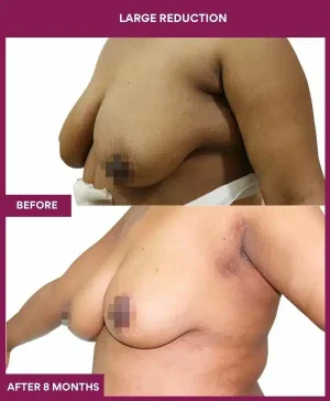 7 large Reduction (3)