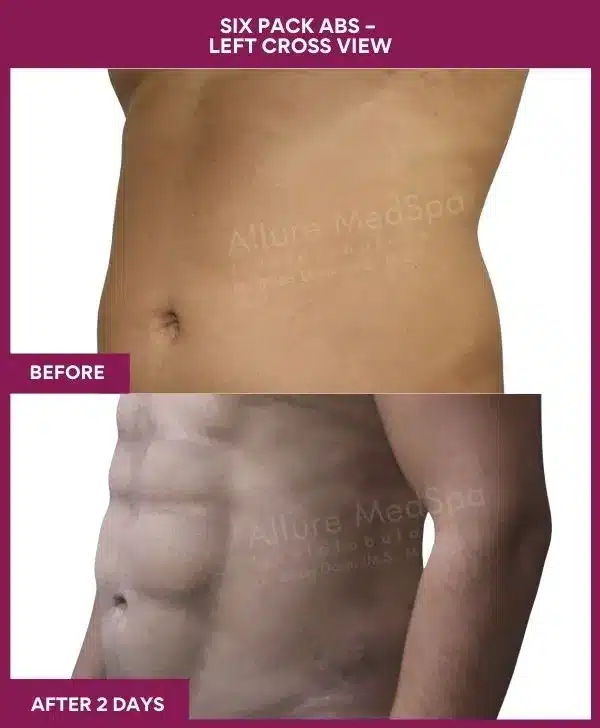 9-Six Pack Abs