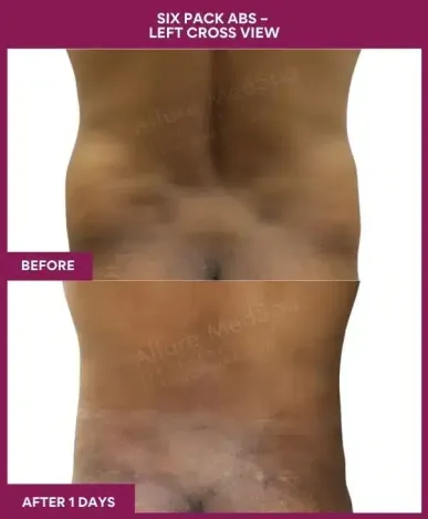 11-10-9-Six Pack Abs-