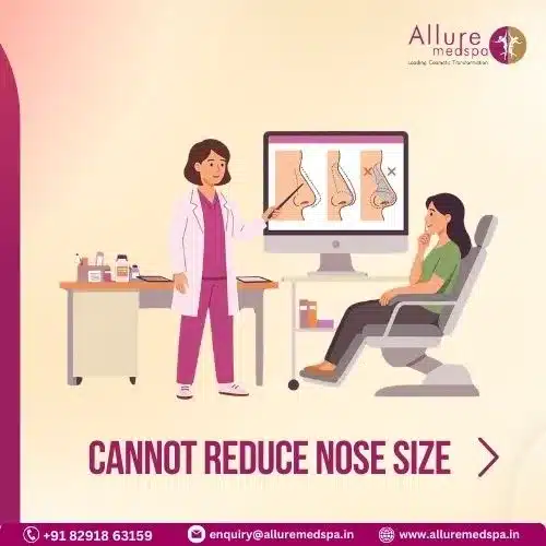 CANNOT REDUCE NOSE SIZE