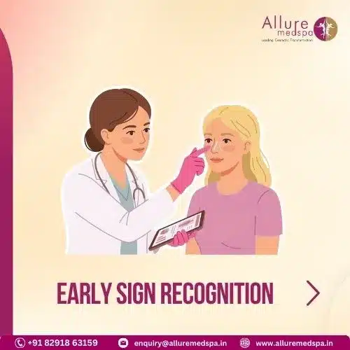 Early Sign Recognition