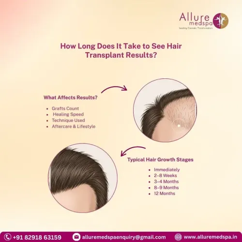 Hair Transplant Results Timeline in Mumbai