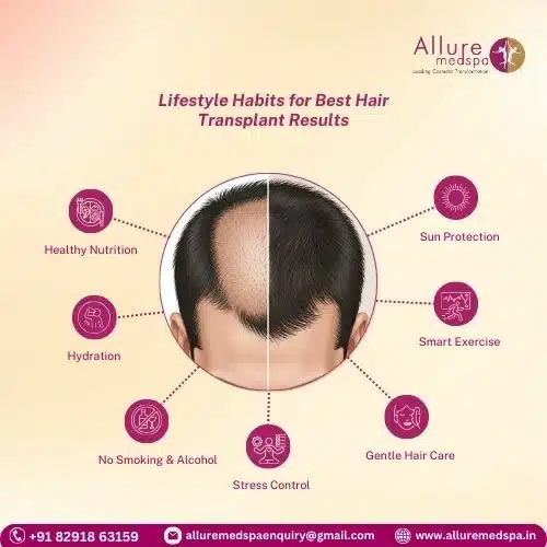 Lifestyle habits for best hair transplant result in Mumbai, India