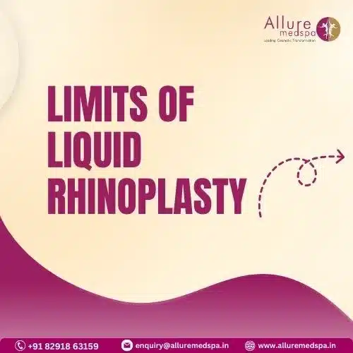 Limits of Liquid Rhinoplasty