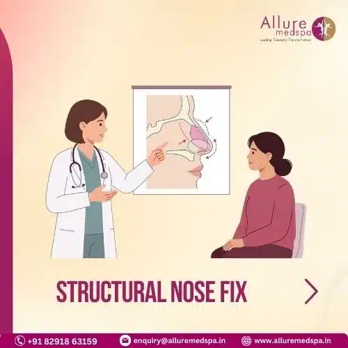 Structural Nose Fix