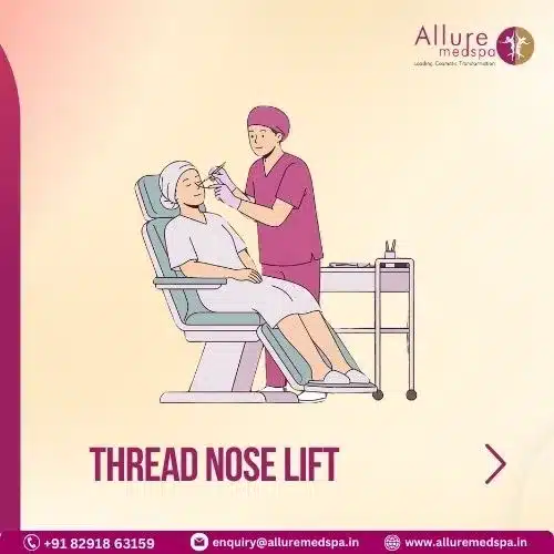 THREAD NOSE LIFT