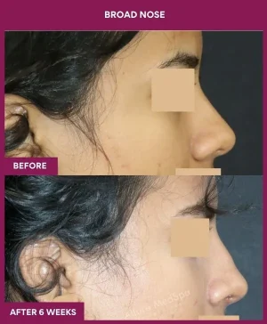 4 BROAD NOSE_12_ (3)