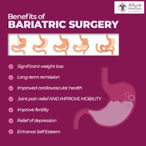 benefits of bariatric surgery: weight loss, increased confidence and fertility at allure medspa mumbai
