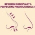 Revision rhinoplasty