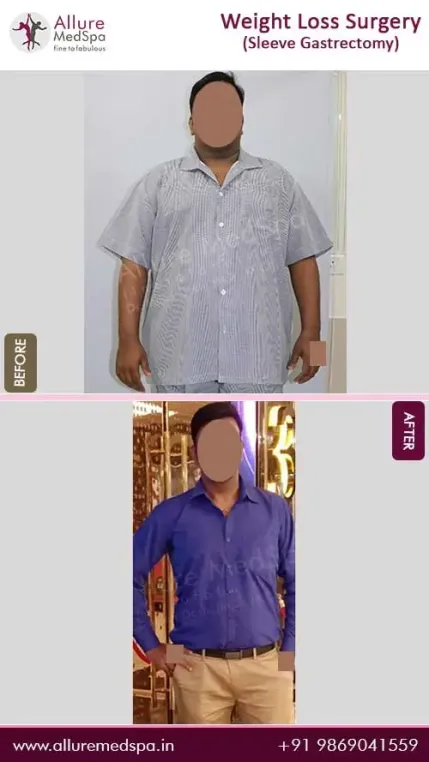 Weight-Loss-Surgery-Before-and-After-Gallery-in-Mumbai-India