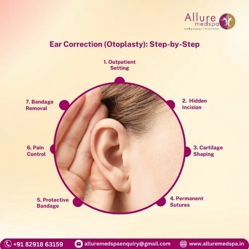 Ear Correction Surgery 18 Ear Correction (Otoplasty)_ Step-by-Step procedure in Mumbai