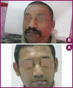 Dr.Shweta-best-four-PigmentationBA-image-3