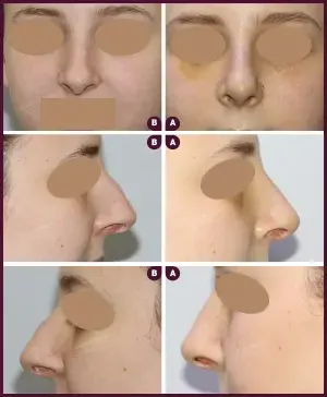 Allure_BIFID_CORRECTION_01-1