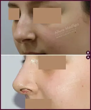 Allure_BIFID_CORRECTION_01-2