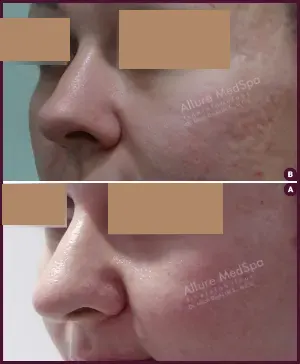 Allure_BIFID_CORRECTION_01-4