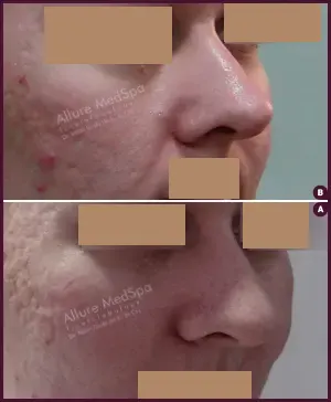 Allure_BIFID_CORRECTION_01-5