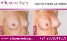 inverted-nipple-correction-before-and-after-pictures-mumbai-india