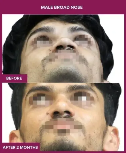 2 male broad nose in Mumbai, India