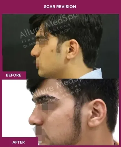 8 Scar Revision (3)_12_